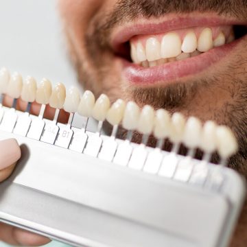 Are There Other Options Asides From Permanent Veneers?